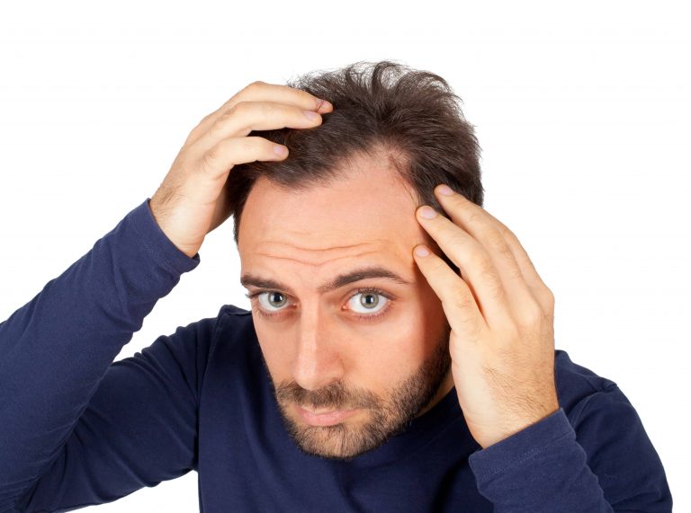 Can Dandruff Cause Hair Loss Health Tenfold
